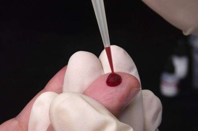 Взятие крови на анализ на паразитов